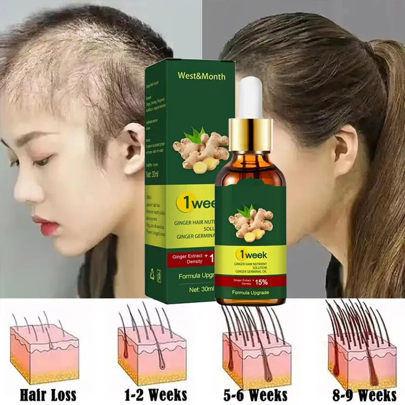 Suero de jengibre para el crec - Licorice Root Sticks reseña y precio