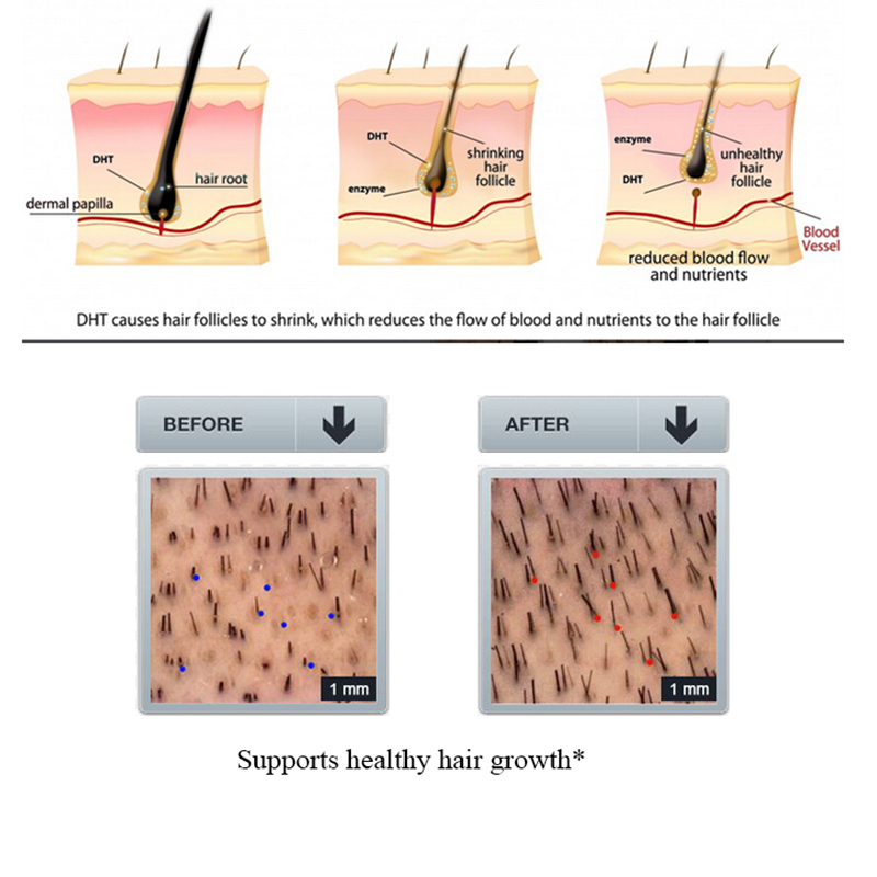 PURC 100ml champú para la caíd - Licorice Root Sticks reseña y precio